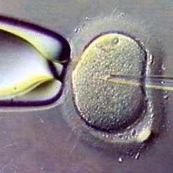 sperme-1.jpg